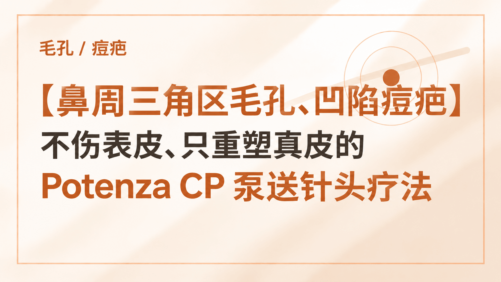 【毛孔 / 痘疤】鼻周三角区毛孔、凹陷痘疤,不伤表皮、只重塑真皮的 Potenza CP 泵送针头疗法